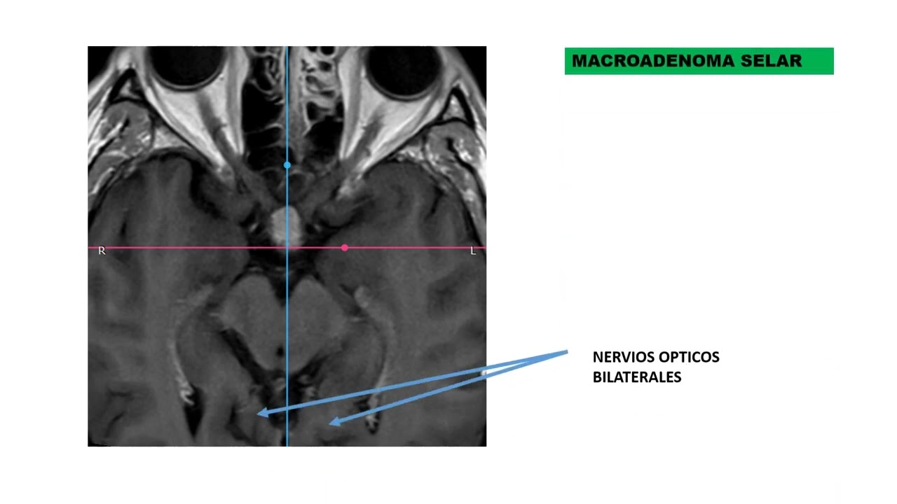 David Tafur Muñoz-2450