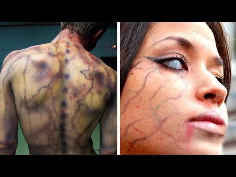 10 people were struck by lightning!