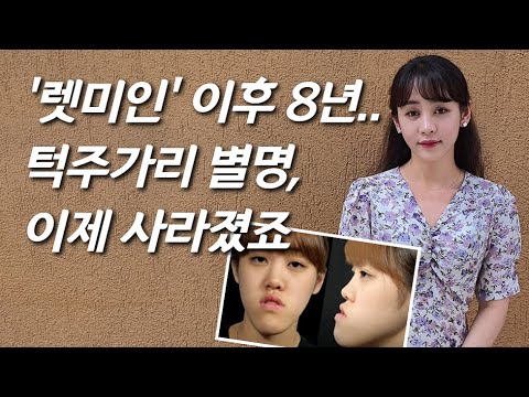 '렛미인' 레전드 주걱턱녀, 8년 만의 근황