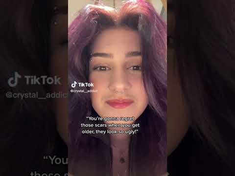 Vent tiktoks because Sh is how you cope #4 |Tw:Sh||Not promoting|