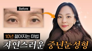 이렇게 자연스러운 중년 눈성형이 있다고?🤔 10년전으로 돌아왔네! 👀✨