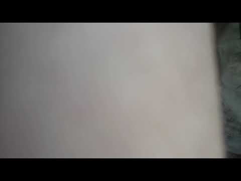 Anorexic Olsen Twin - I guess that's what brains look like Cover