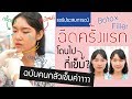 โบท็อก ลดริ้วรอย