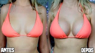 SILICONE- Preço, Como Foi e Resultados! | Amanda Domenico