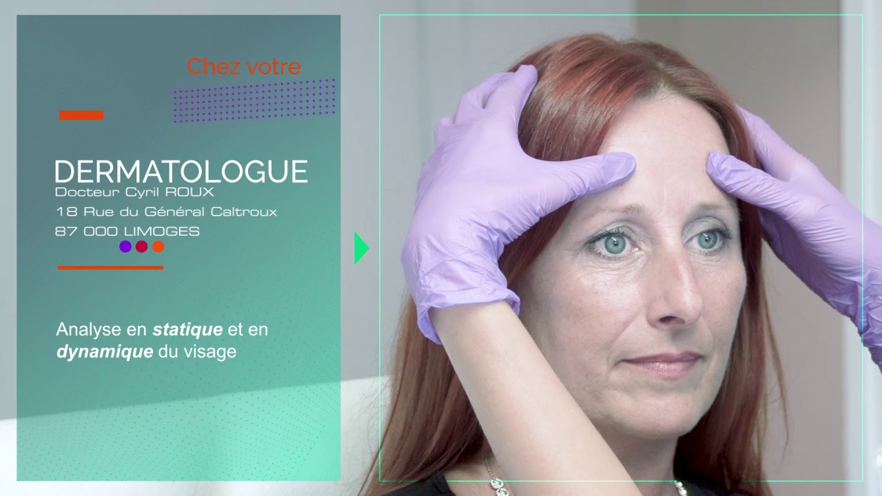 Correction de la ride du Lion par injection de Botox