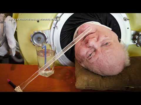 Paul Alexander dies after spending more than 70 years inside an iron lung
