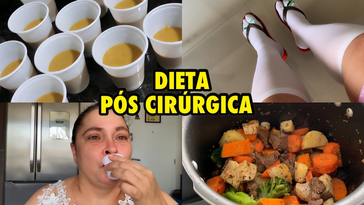 SEGUNDO DIA APÓS A CIRURGIA BARIÁTRICA | DIETA LIQUIDA NO PÓS-OPERATÓRIO