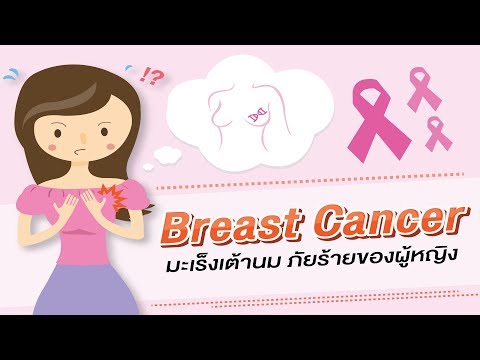 การผ่าตัดเต้านมใน Rostov NCRW ผู้หญิงคนหนึ่งในชุดว่ายน้ำที่มีหน้าอกเล็ก