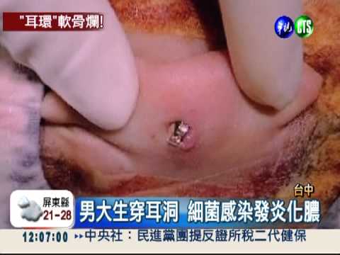 男大生穿耳洞 軟骨遭細菌吃光