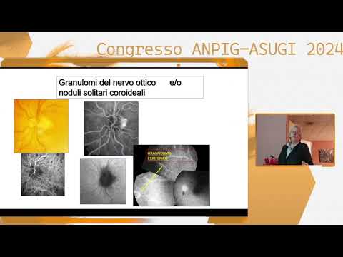 Congresso  - Implicazione Oculare delle Malattie Autoimmunitarie