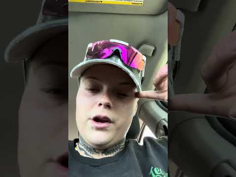 Day 6!!!!! Withdrawing off of 18mg!!! Of Suboxone, cold turkey!!!!