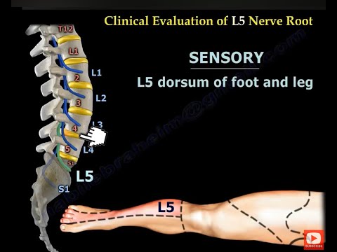 Lower Extremity Nerve Conditions: Foot Drop, Tarsal Tunnel, and Morton's Neuroma