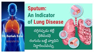 దగ్గినప్పుడు తెమడ (Sputum) రంగును బట్టి ఊపిరితిత్తులలో ఏం జరిగింది తెలుసుకోండి? Dr. Satish Erra's Homeopathy Clinics