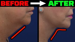 Tansavatdi Facial Plastic Surgery