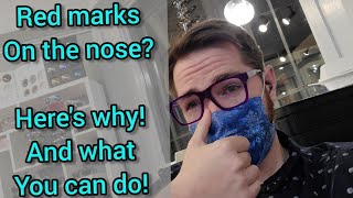 -Beauty Hack to Prevent Red Marks On Nose From Glasses! Stop Red Mark From Glasses!