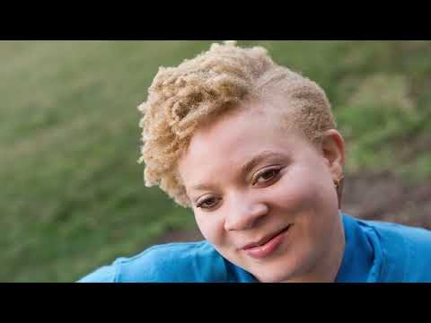 The Beautiful WHITE  'BLACK' Africans.