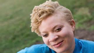 The Beautiful WHITE  'BLACK' Africans.