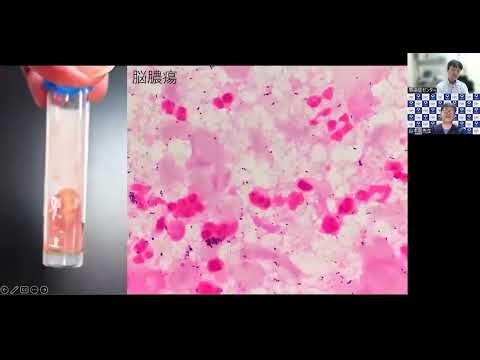 看護学科 2022年09月21日(水) ID笠原と道場山本の感染症よもやま話