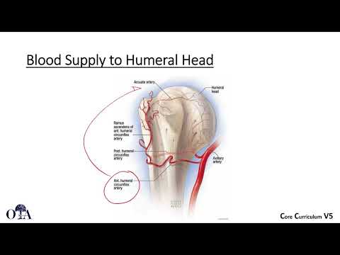 Proximal humerus fractures - 1 of 2