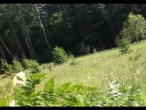 Arch ból kości stopy Jak usunąć guzek z palucha