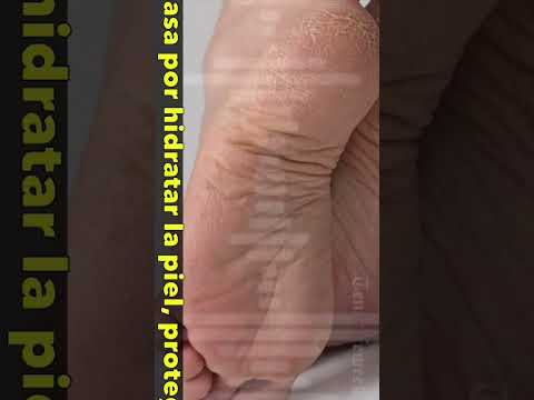 😱 ¿Cómo prevenir y curar los talones agrietados? #SALUD #SHORTS