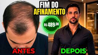 Nioxin System Kit 2  A Ciência por Trás do Tratamento nº 1 do Mundo Para Raleamento Capilar!