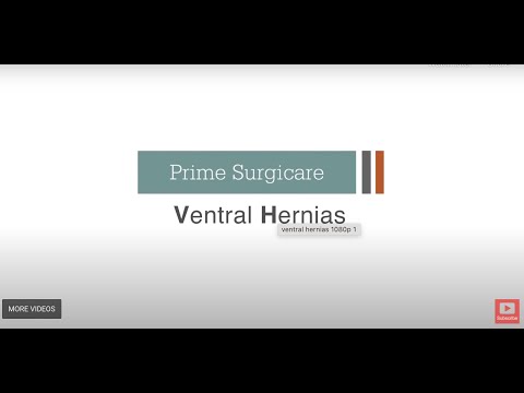 Ventral Hernia Surgeon Dr. Sowemimo Explains Laparoscopic Hernia Repair