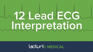 Systematic ECG Interpretation (9 Steps) | Cardiology