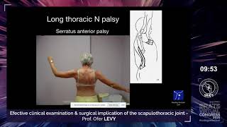 Best practices in shoulder arthroscopy