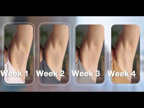 Want Permanent Hair Reduction at Home? Try Braun At-home Laser Hair Removal