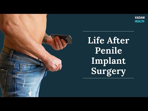 Life After Penile Implant Surgery