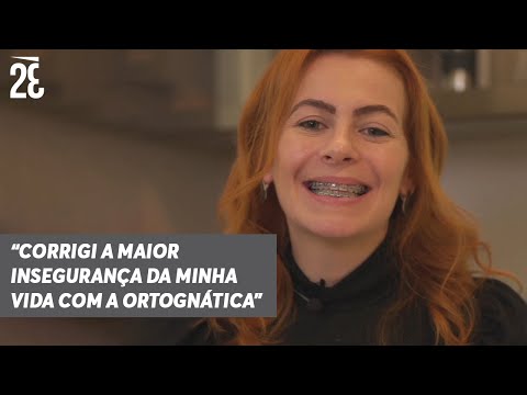 Depoimento da paciente Helena 44 dias após cirurgia ortognática | Dr. Zé Bastos