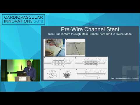 CVI2018 Session: Innovation in bifurcation treatment - Jaikirshan Khatri, MD