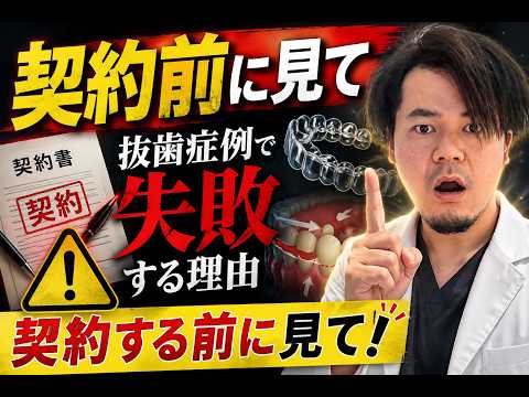 【契約前に見て】抜歯症例で失敗する理由