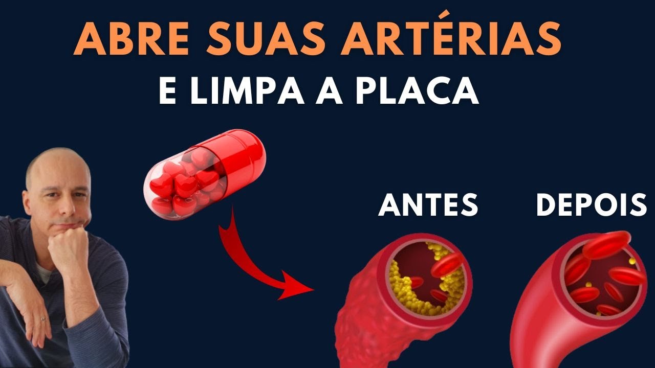 Abre as ARTÉRIAS e Reduz a PLACA || Dr. Moacir Rosa