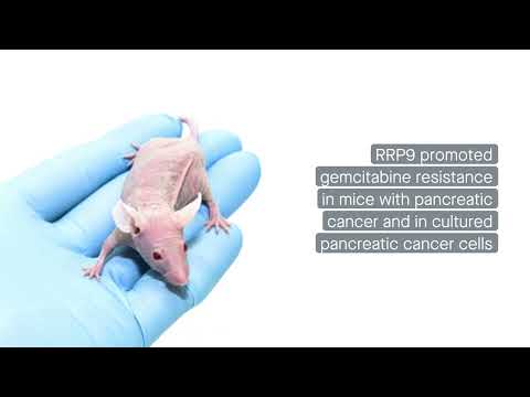 A proteína RRP9 promove resistência à gencitabina no câncer de pâncreas ativando a via AKT