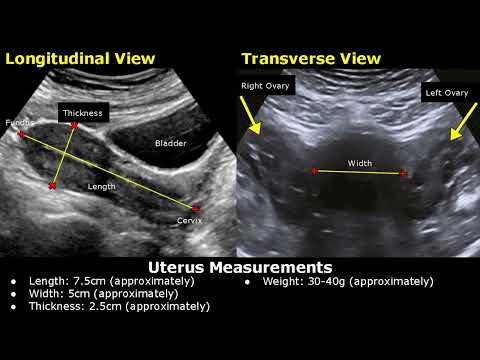 How To Measure Uterus On Ultrasound | Uterine Length, Width, AP Thickness Measurements TA/TVS USG