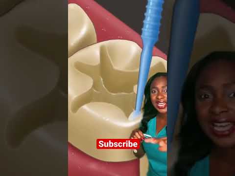 How a cavity is filled #shorts #animation