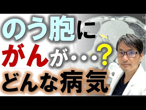 優性多発性嚢胞腎 - 定義