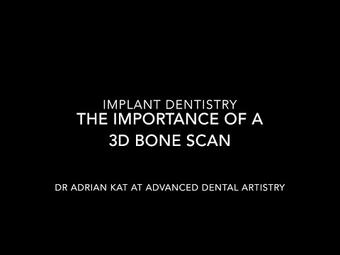download lagu mp3 mp4 Dental Implants Fairfield Ct, download lagu Dental Implants Fairfield Ct gratis, unduh video klip Dental Implants Fairfield Ct