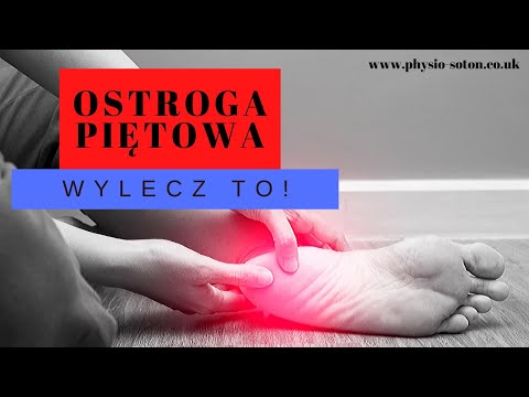 Ból stopy i ostroga piętowa. Wylecz to!