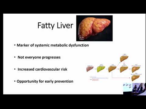 MASLD SymposiumFatty Liver on Ultrasound - Ignore, Investigate or Intervene?