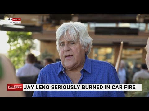 , title : 'Jay Leno seriously burnt after car fire'