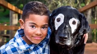 8-Year-Old Boy Embarrassed Of Vitiligo Meets Dog With Same Skin Condition