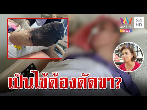 คลิกเพื่อดูคลิปวิดีโอ