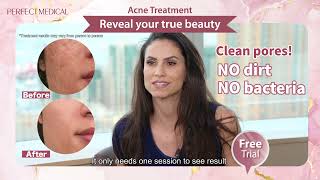 Camila&#39;s Acne Treatment Experience [Free Session Giveaway]