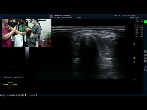 Live Stream of Upper Limb Part II US with Dr. Heakyung Kim