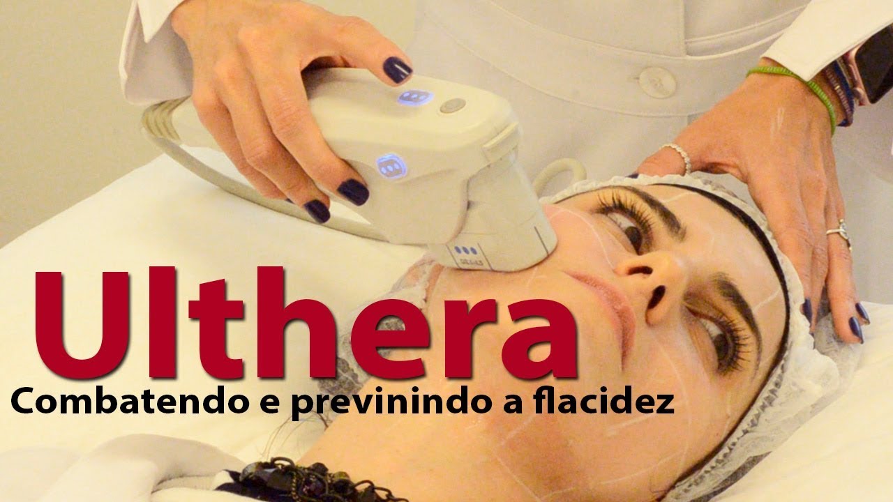 Pele mais jovem | Tudo sobre o tratamento Ulthera | Como funciona ? Dói ? Demora ?