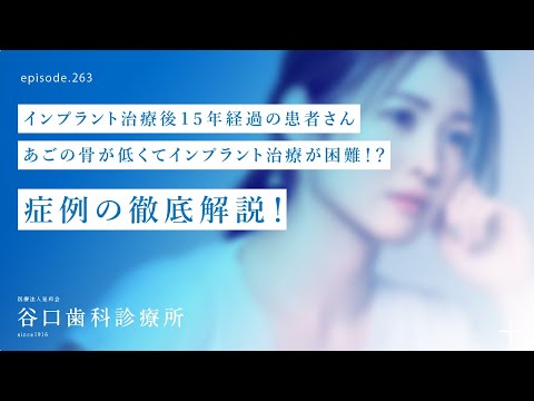 第263話  インプラント治療後15年経過患者さん-スペシャル・インタビュー-低いあごの骨に短いインプラントの可能性‼️-4Sではない通常インプラント治療