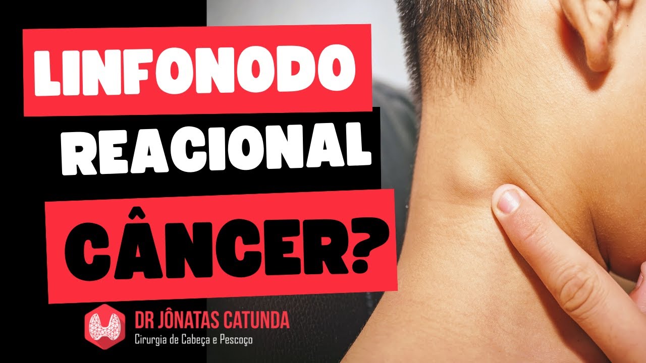 Linfonodo reacional: como saber se é câncer?